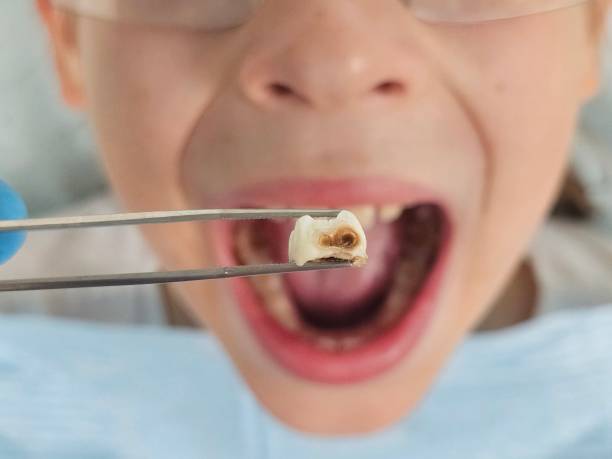 Best Urgent Dental Care for Toothaches in Pho, IL
